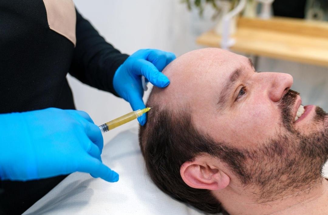 PRP for Hair Loss clinical or result imagery