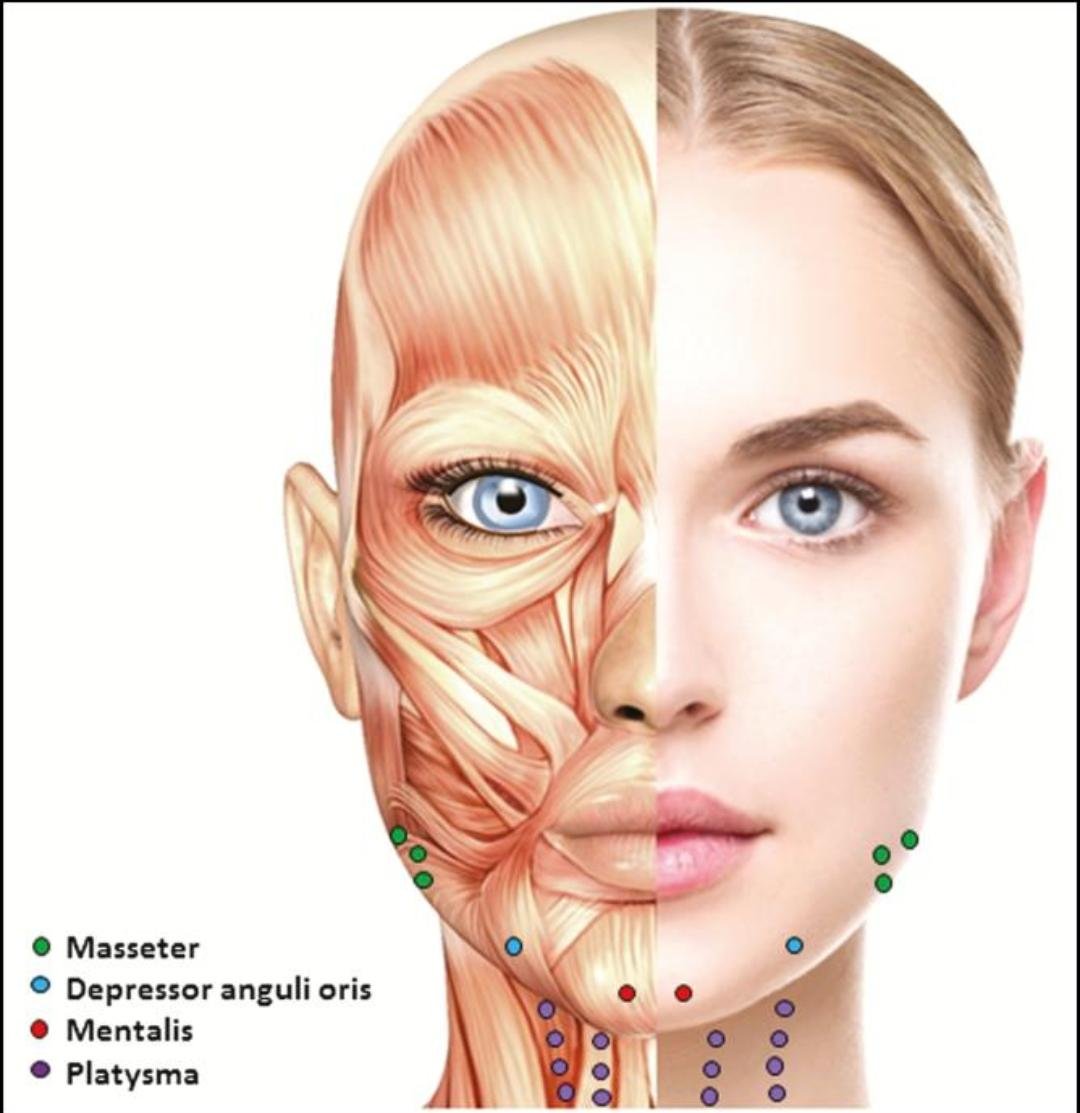 Botulinum Toxin Treatment clinical or result imagery