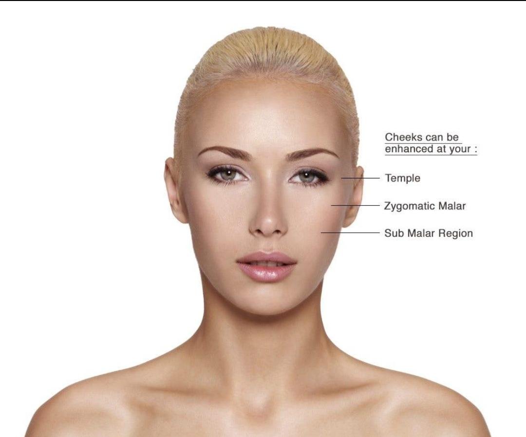 Cheek Augmentation clinical or result imagery