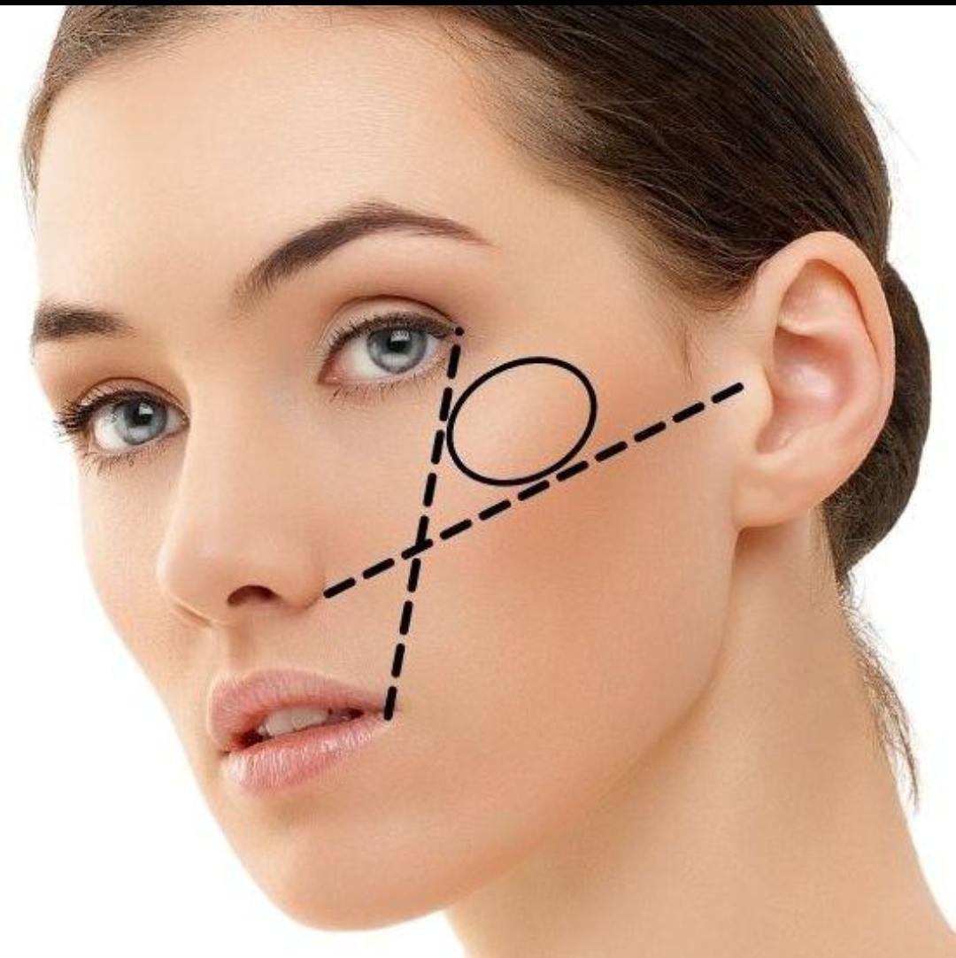 Cheek Augmentation example from the practice media library