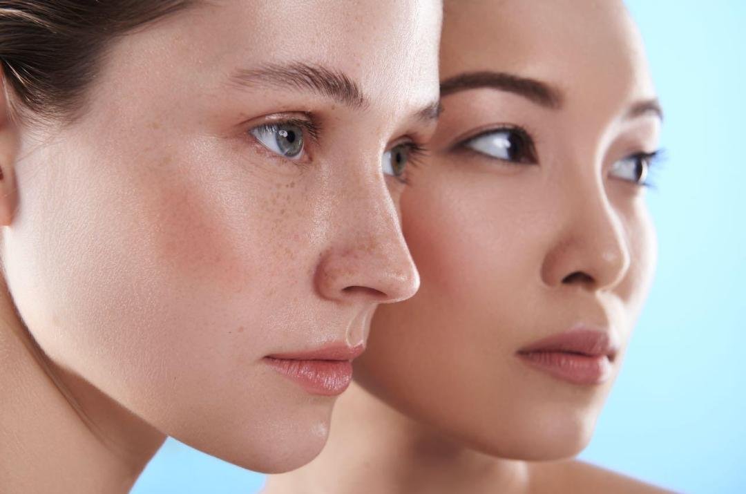 Editorial image representing cheek augmentation