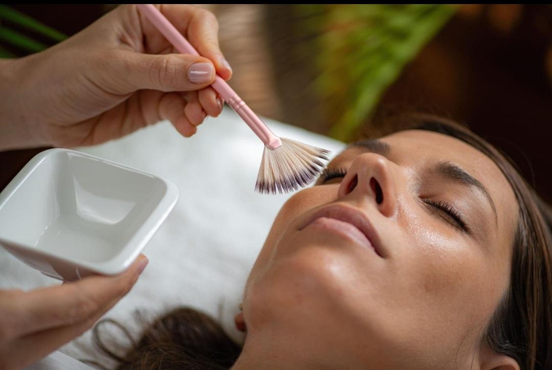 Chemical Peel clinical or result imagery