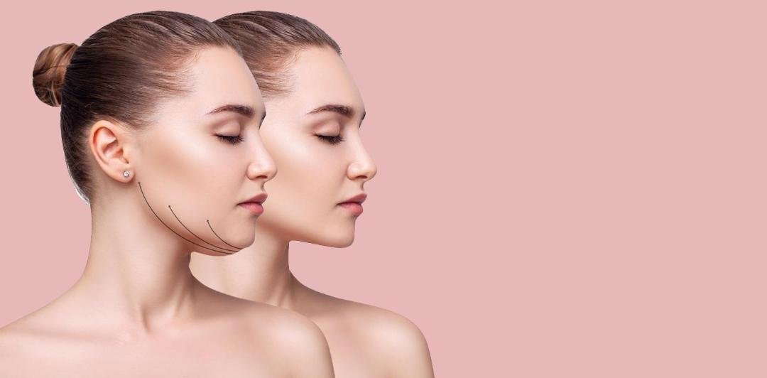 Editorial image representing double chin treatment