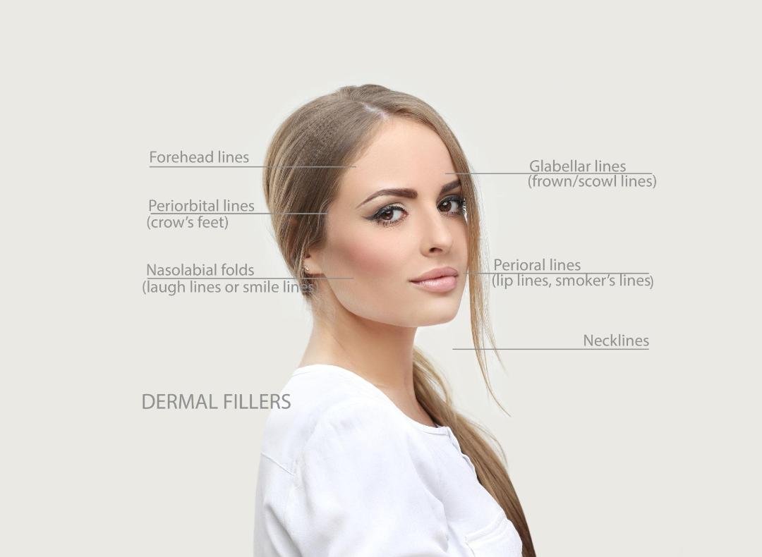 Dermal Fillers clinical or result imagery