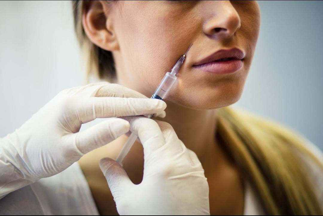 Dermal Fillers example from the practice media library
