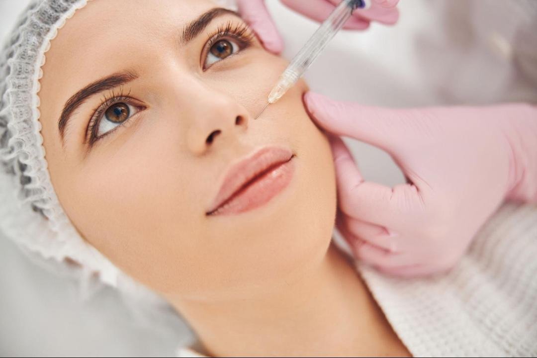 Editorial image representing dermal fillers