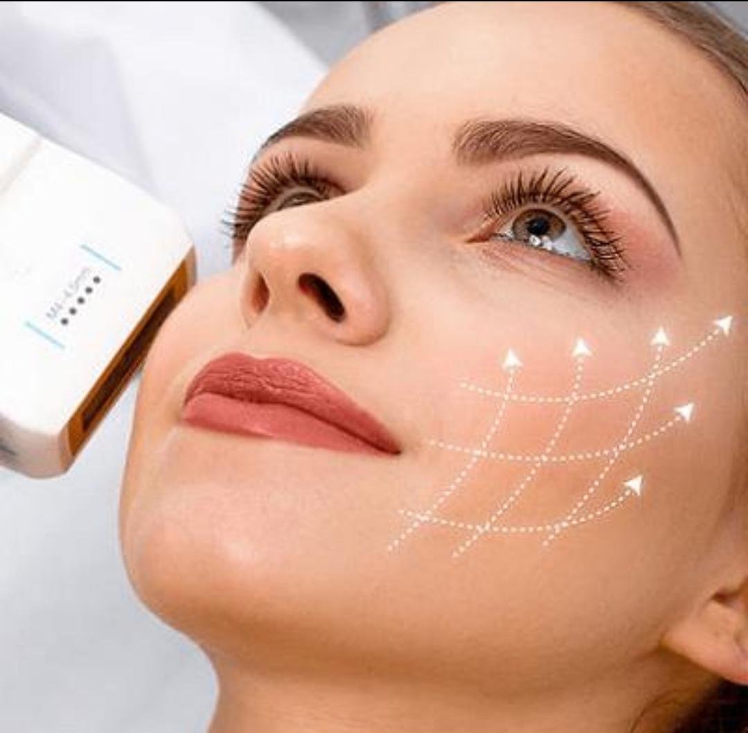 HIFU Skin Tightening example from the practice media library