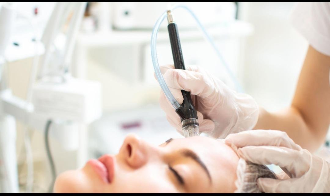 Hydrafacial / Hydradermabrasion clinical or result imagery