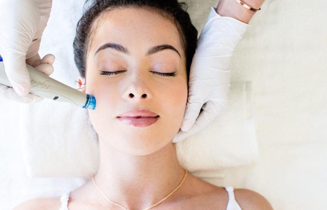 Hydrafacial / Hydradermabrasion clinical or result imagery