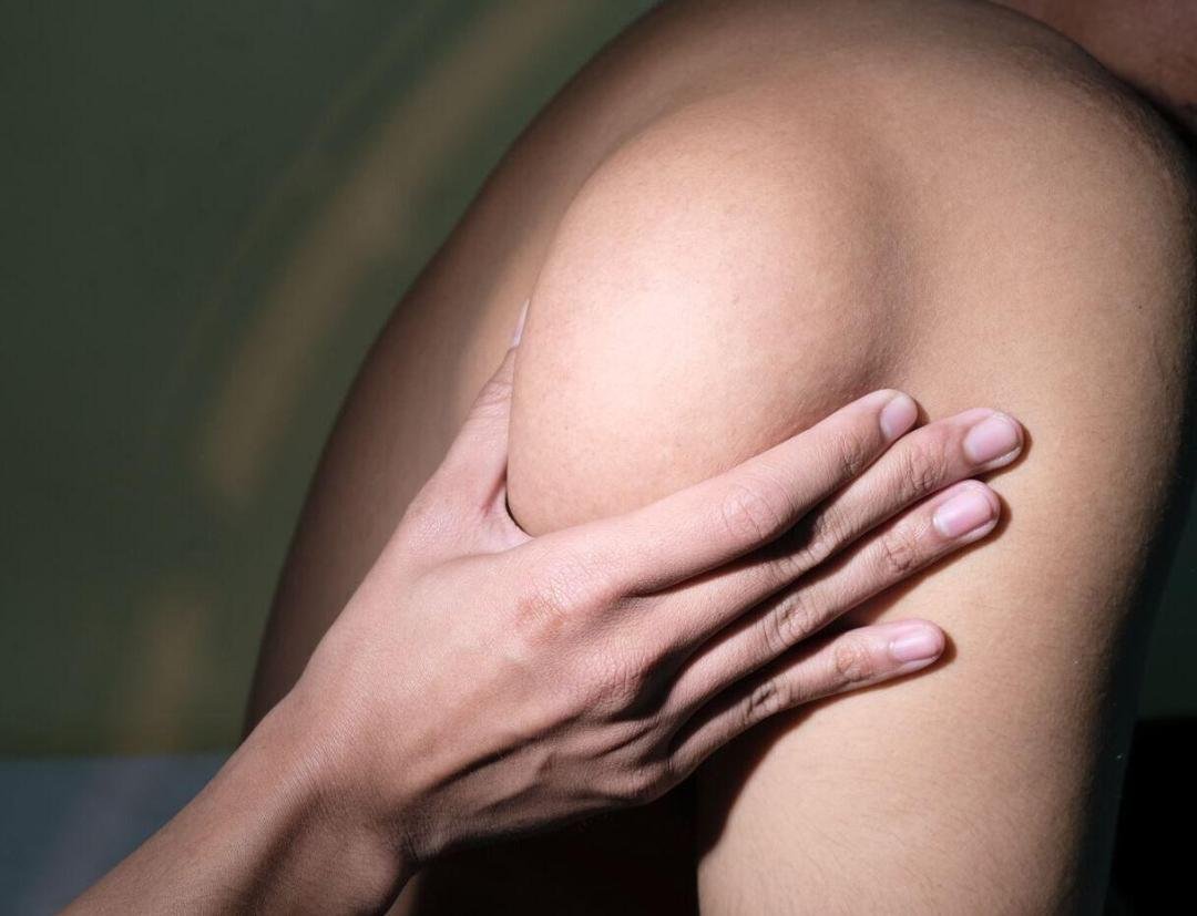 Lipoma Excision clinical or result imagery