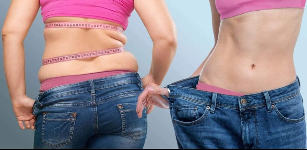 Liposuction _1