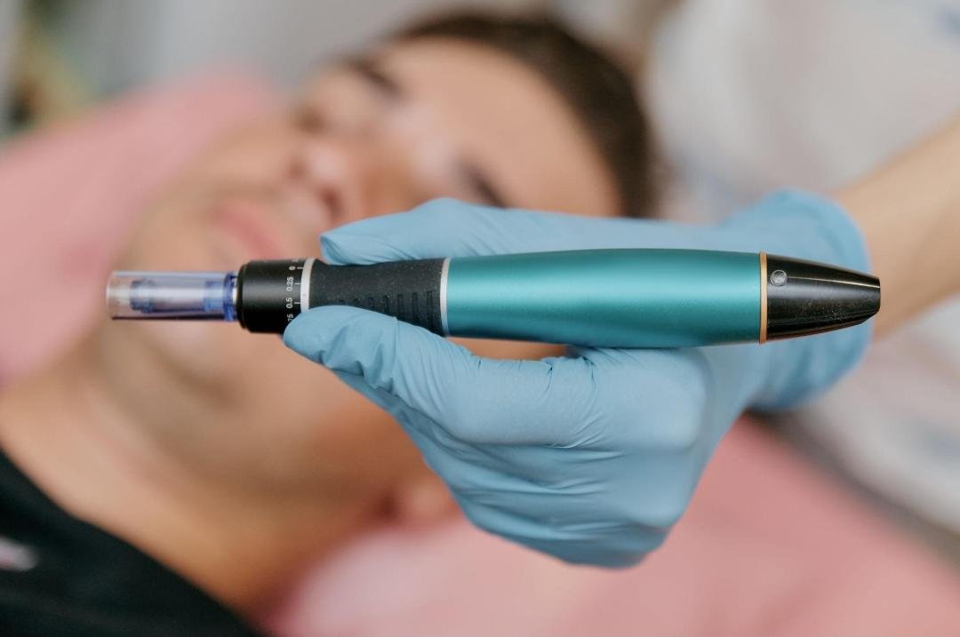 Microneedling example from the practice media library