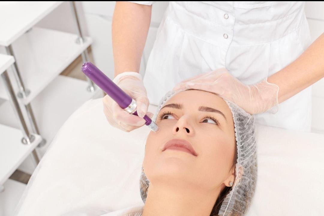 Editorial image representing microneedling