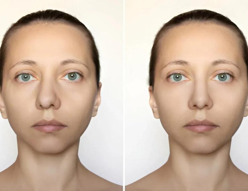 NOSE JOB_1