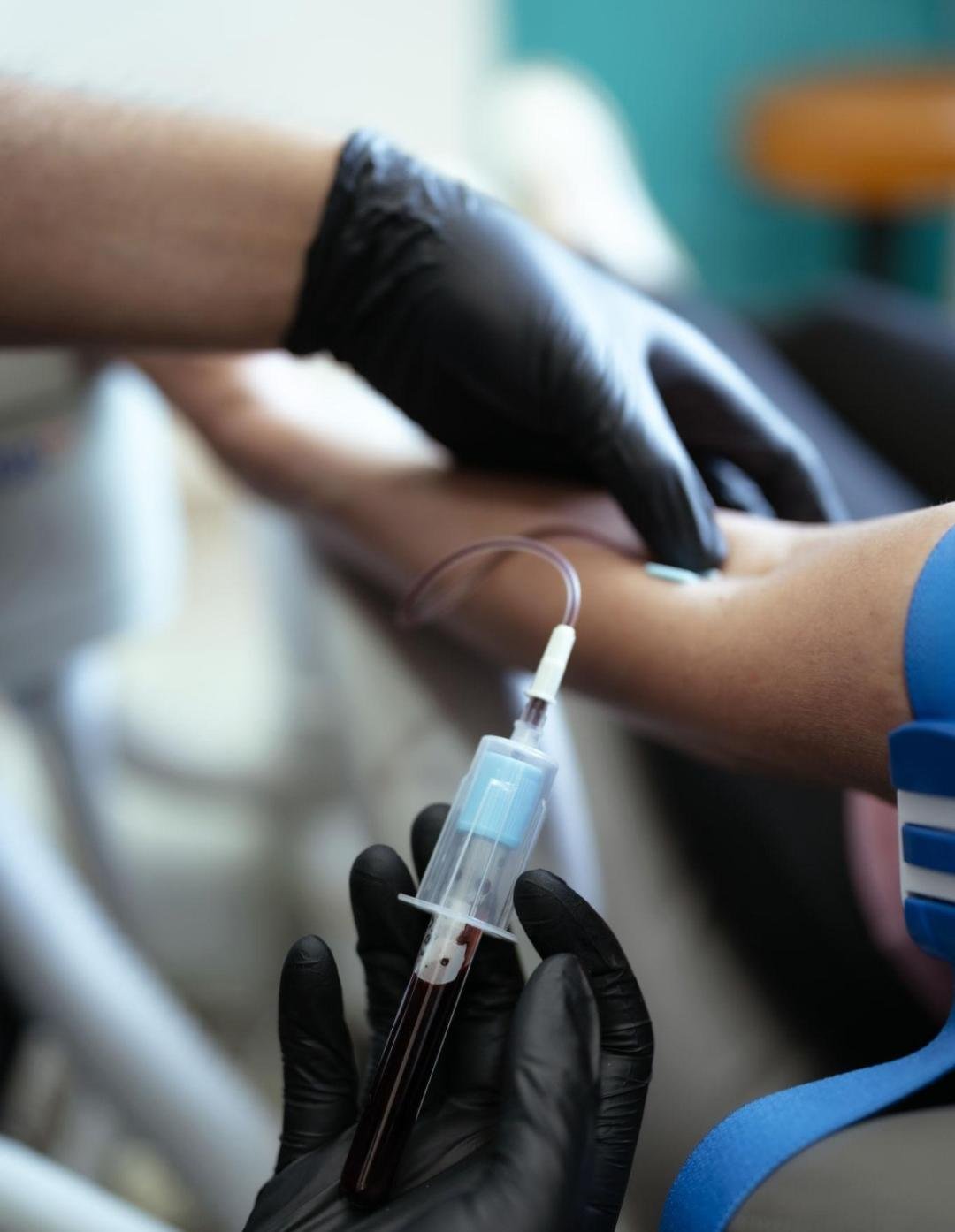 PRP Skin Rejuvenation clinical or result imagery