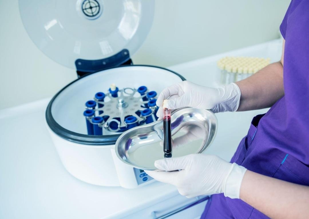 PRP Skin Rejuvenation example from the practice media library