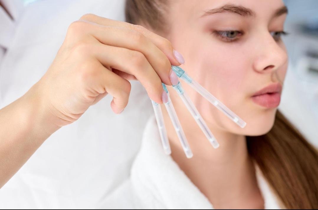 Editorial image representing thread lift