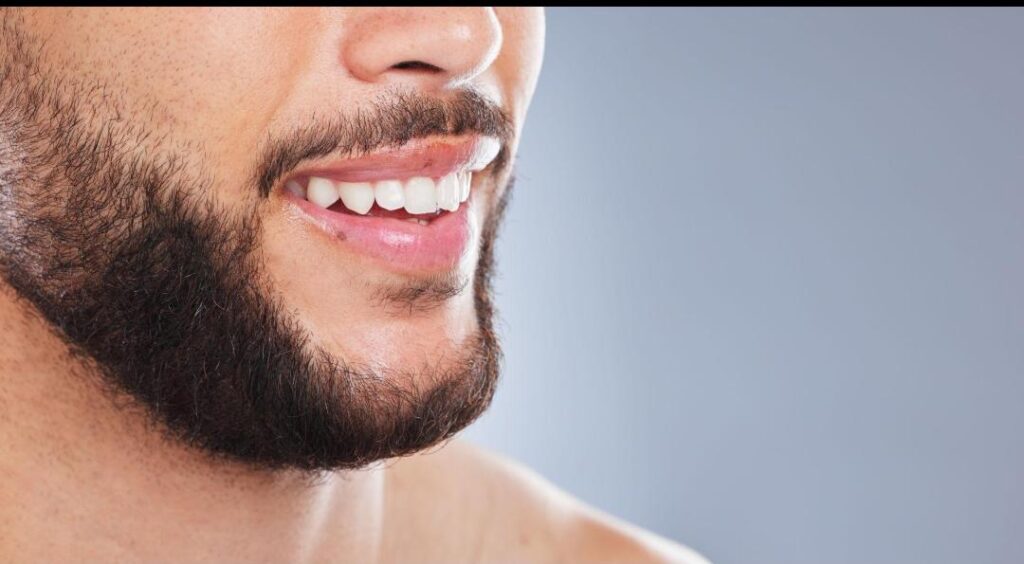 beard transplantation_3