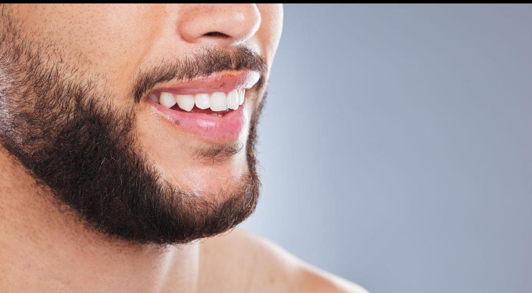 Beard Transplantation example from the practice media library