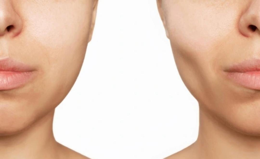Face Slimming example from the practice media library