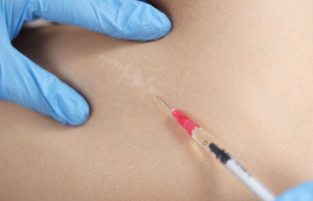 Editorial image representing scar management